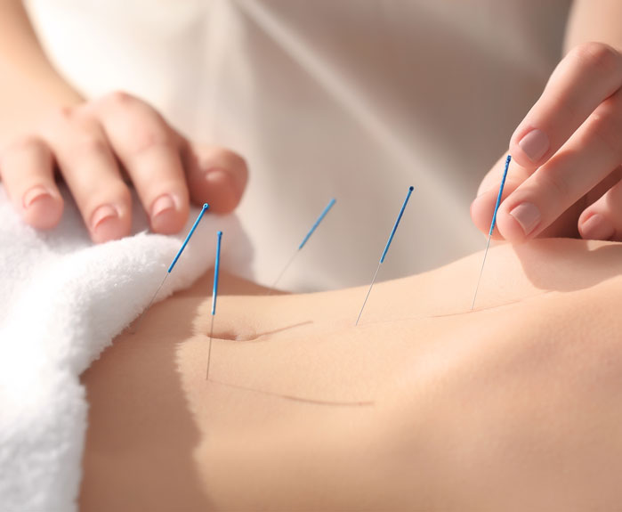 Tri Points Acupuncture and Hypnotherapy
